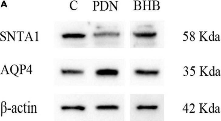 Fig.4.A showing Western Blotting from the publication: β-Hydroxybutyrate Attenuates Painful Diabetic Neuropathy via Restoration of the Aquaporin-4 Polarity in the Spinal Glymphatic System.