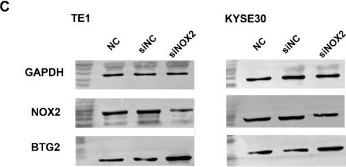 Fig.3.C showing Western Blotting in a Homo sapiens (Human) sample from the publication: Targeting NADPH oxidase 2 suppresses the growth of esophageal squamous cell carcinoma by regulating BTG2 pathway.