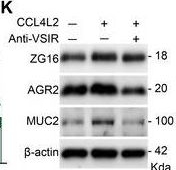 Fig.6.K showing Western Blotting from the publication: Gut Dysbiosis Drives Inflammatory Bowel Disease Through the CCL4L2-VSIR Axis in Glycogen Storage Disease.