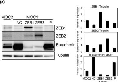 Fig.1.C showing Western Blotting from the publication: Roles of ZEB1 and ZEB2 in E-cadherin expression and cell aggressiveness in head and neck cancer.