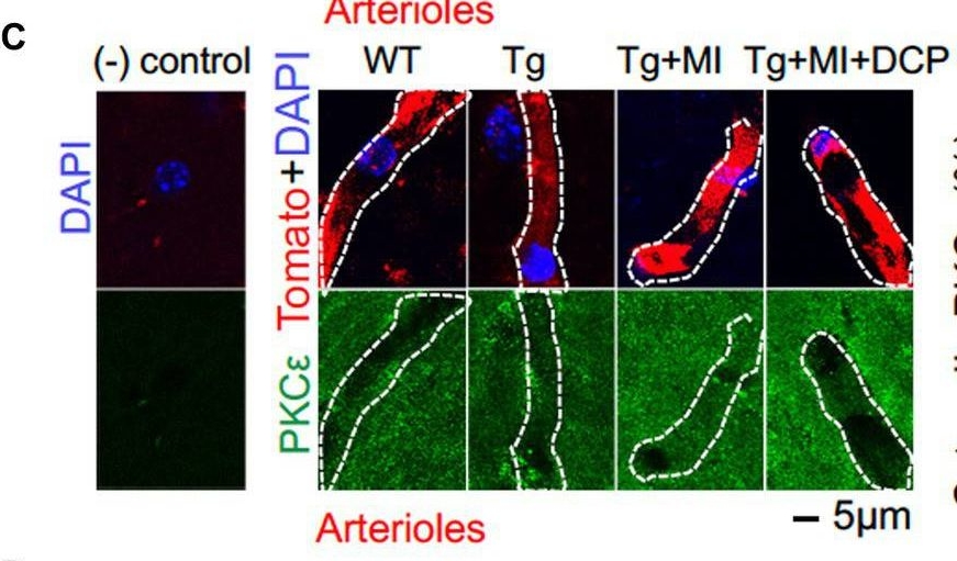 Fig.3.C showing Immunohistochemistry-immunofluorescence in a Mus musculus (House mouse) sample from the publication: PKCε activator protects hippocampal microvascular disruption and memory defect in 3×Tg-Alzheimer's disease mice with cerebral microinfarcts.