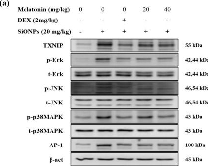 Fig.4.A showing Western Blotting in a Mus musculus (House mouse) sample from the publication: Melatonin Alleviates Silica Nanoparticle-Induced Lung Inflammation via Thioredoxin-Interacting Protein Downregulation.