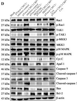 Fig.4.D showing Western Blotting from the publication: C-reactive protein-induced injury in Mycoplasma pneumoniae-infected lung epithelial cells is mediated by the P38 MAPK/mitochondrial apoptosis pathway.