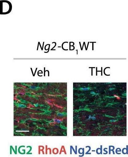 Fig.4.D showing Immunohistochemistry-immunofluorescence from the publication: Cannabinoid CB1 receptor gene inactivation in oligodendrocyte precursors disrupts oligodendrogenesis and myelination in mice.