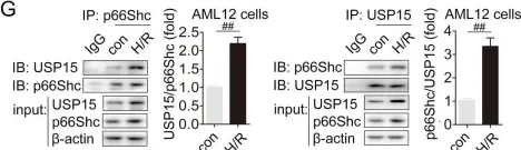 Fig.3.G showing Western Blotting from the publication: USP15 regulates p66Shc stability associated with Drp1 activation in liver ischemia/reperfusion.