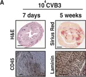 Fig.3.A showing Immunohistochemistry in a Mus musculus (House mouse) sample from the publication: Extracellular SPARC increases cardiomyocyte contraction during health and disease.