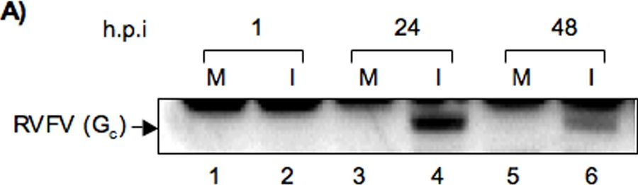 Fig.1.A showing Western Blotting in a Homo sapiens (Human) sample from the publication: Alteration in superoxide dismutase 1 causes oxidative stress and p38 MAPK activation following RVFV infection.