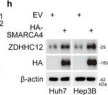 Fig.2.H showing Western Blotting from the publication: ZDHHC12 Palmitoylates HDAC8 to Promote the Progression of Hepatocellular Carcinoma Associated with a Diet High in Saturated Fatty Acids.