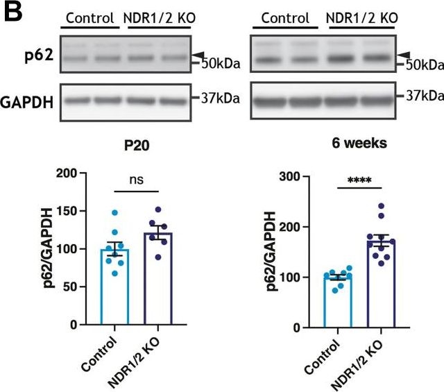 Loss of NDR1/2 kinases impairs endomembrane trafficking and autophagy leading to neurodegeneration.