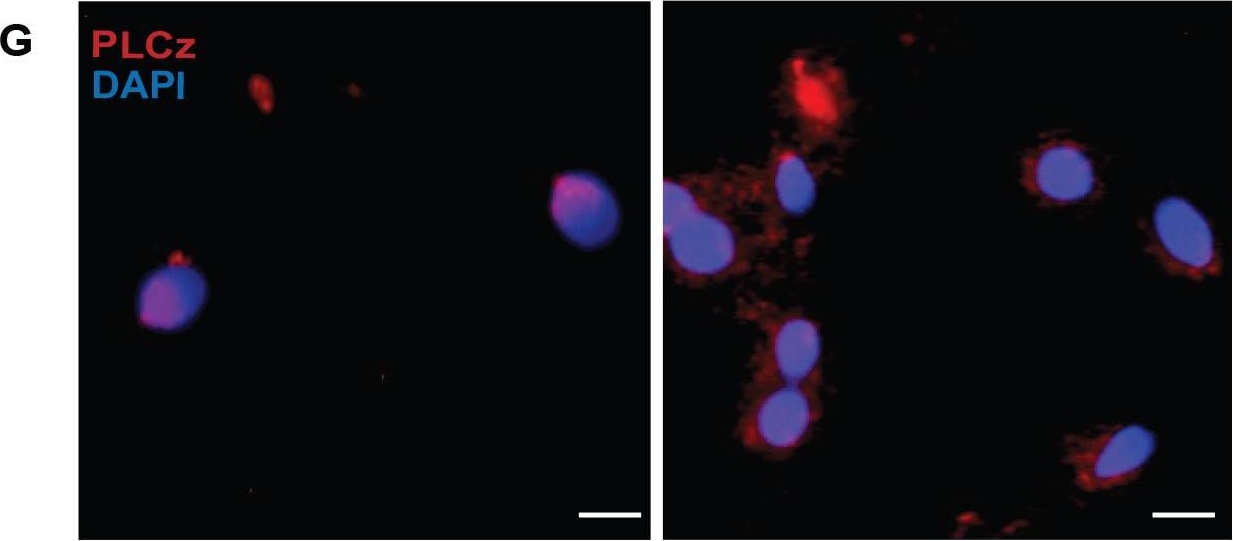 Fig.7.G showing Immunohistochemistry-immunofluorescence in a Mus musculus (House mouse) sample from the publication: Cylicins are a structural component of the sperm calyx being indispensable for male fertility in mice and human.