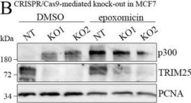 p300 (D8Z4E) Rabbit Monoclonal Antibody | Cell Signaling Technology