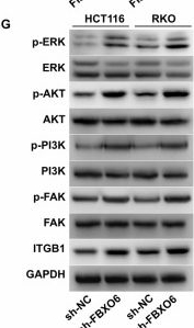 Fig.5.G showing Western Blotting from the publication: FBXO6 regulates colon cancer migration and invasion via ITGB1 ubiquitination and downstream signaling.