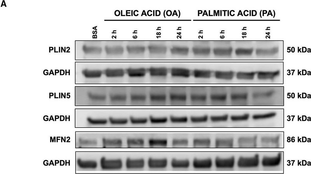 Differential Effects of Oleic and Palmitic Acids on Lipid Droplet-Mitochondria Interaction in the Hepatic Cell Line HepG2.