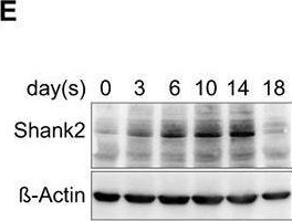 Fig.1.E showing Western Blotting from the publication: Downregulation of the Autism Spectrum Disorder Gene Shank2 Decreases Bone Mass in Male Mice.