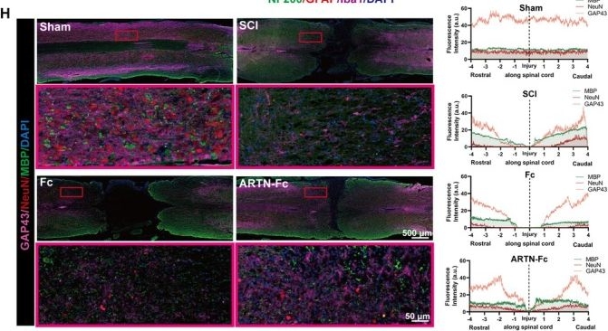 Fig.5.H showing Immunohistochemistry-immunofluorescence from the publication: Recombinant Artemin-Fc Fusion Protein Attenuates TLR4/NF-κB-Associated Neuroinflammation and Modulates Inhibitory/Excitatory Synaptic Marker Expression After Spinal Cord Injury.