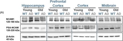 NCAM1 (CD56) (E7X9M) Rabbit Monoclonal Antibody | Cell Signaling