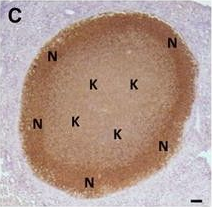 Fig.4.C showing Immunohistochemistry in a Bos taurus (Bovine) sample from the publication: The C3HeB/FeJ mouse model recapitulates the hallmark of bovine tuberculosis lung lesions following Mycobacterium bovis aerogenous infection.