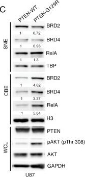 Fig.1.C showing Western Blotting from the publication: BRD2 bromodomain-mediated regulation of cell state plasticity modulates therapy response in glioblastoma.