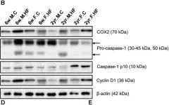Fig.7.B showing Western Blotting from the publication: Microbial Changes and Host Response in F344 Rat Colon Depending on Sex and Age Following a High-Fat Diet.