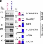 Fig.3.E showing Western Blotting from the publication: Defective N-glycosylation of IL6 induces metastasis and tyrosine kinase inhibitor resistance in lung cancer.