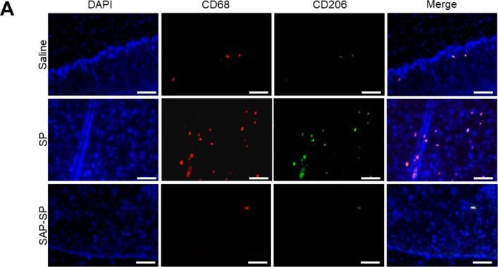 Fig.5.A showing Immunohistochemistry-immunofluorescence from the publication: Self-assembled peptide-substance P hydrogels alleviate inflammation and ameliorate the cartilage regeneration in knee osteoarthritis.