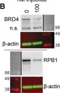 Fig.4.B showing Western Blotting in a Homo sapiens (Human) sample from the publication: Super-enhancers and efficacy of triptolide in small cell carcinoma of the ovary hypercalcemic type.