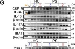 Fig.4.G showing Western Blotting from the publication: Systemic CSF1R Targeting Depletes Pathogenic MPS Bubs and Ameliorates Psoriasis via PPARα-mediated Resolution.