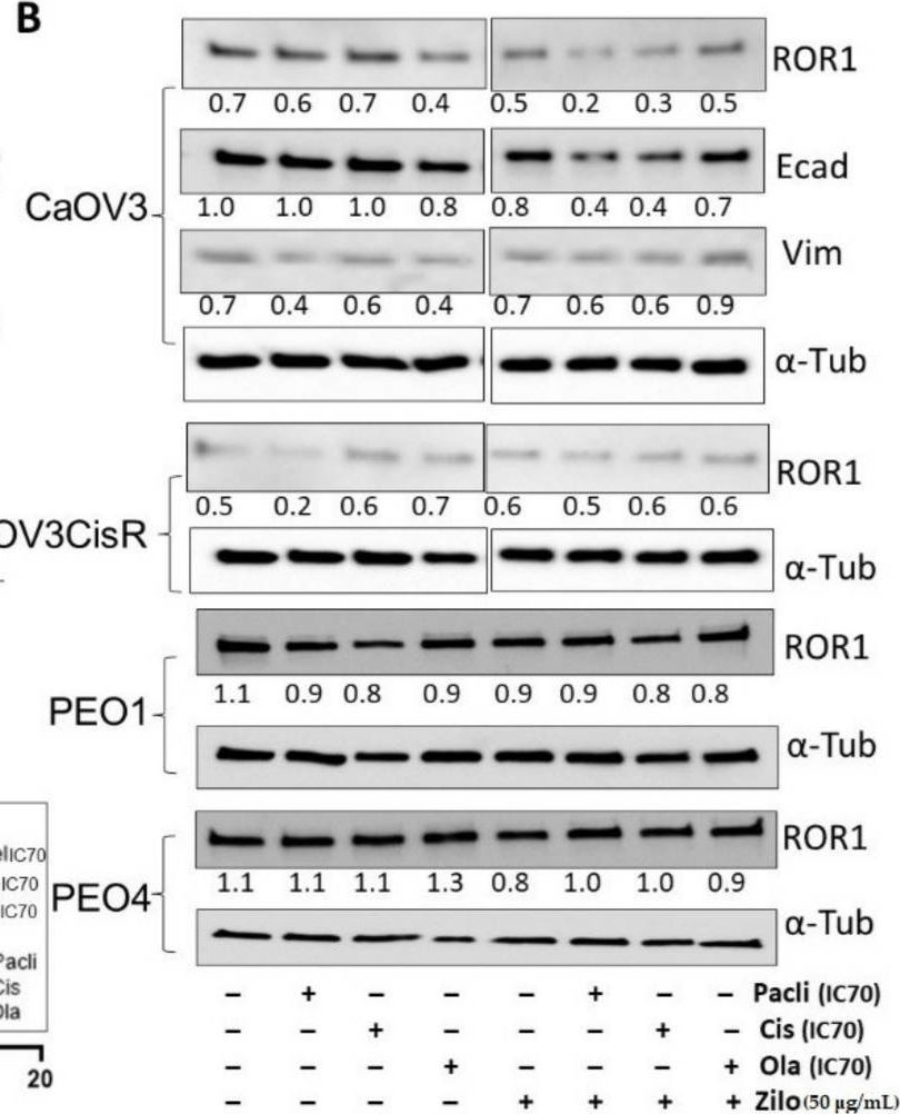 Fig.2.B showing Western Blotting in a Homo sapiens (Human) sample from the publication: The Anti-ROR1 Monoclonal Antibody Zilovertamab Inhibits the Proliferation of Ovarian and Endometrial Cancer Cells.