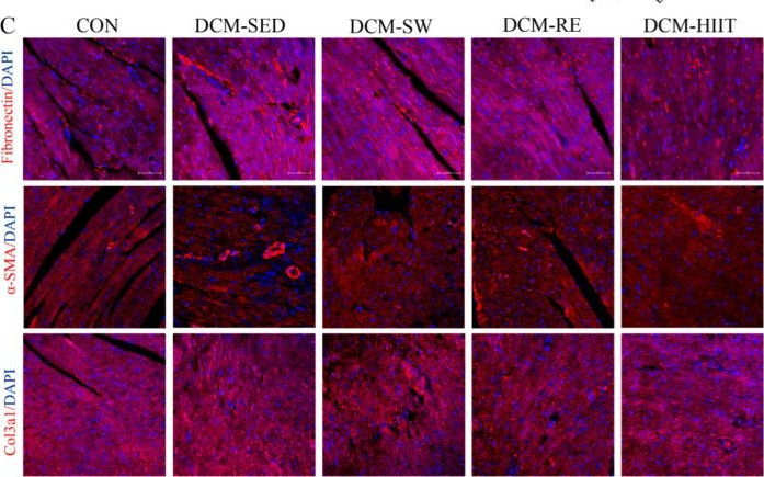 Fig.4.C showing Immunohistochemistry-immunofluorescence in a Mus musculus (House mouse) sample from the publication: Beneficial Effects of Different Types of Exercise on Diabetic Cardiomyopathy.