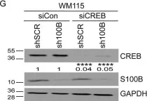 Fig.6.G showing Western Blotting from the publication: The calcium-binding protein S100B reduces IL6 production in malignant melanoma via inhibition of RSK cellular signaling.