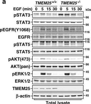 Fig.3.A showing Western Blotting from the publication: TMEM25 inhibits monomeric EGFR-mediated STAT3 activation in basal state to suppress triple-negative breast cancer progression.