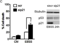 Fig.3.C showing Western Blotting in a Homo sapiens (Human) sample from the publication: Serum-nutrient starvation induces cell death mediated by Bax and Puma that is counteracted by p21 and unmasked by Bcl-x(L) inhibition.