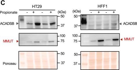 Fig.4.C showing Western Blotting from the publication: Differential utilization of vitamin B12-dependent and independent pathways for propionate metabolism across human cells.