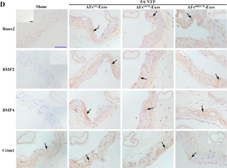 Fig.7.D showing Immunohistochemistry in a Mus musculus (House mouse) sample from the publication: Vascular wall microenvironment: exosomes secreted by adventitial fibroblasts induced vascular calcification.
