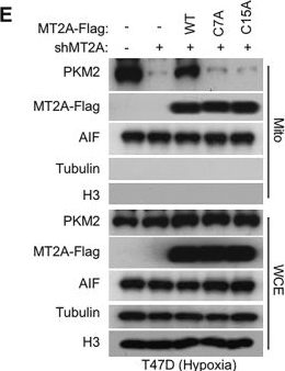Fig.5.E showing Western Blotting in a Homo sapiens (Human) sample from the publication: Hypoxia-induced MT2A-tetrameric PKM2 interaction maintains PKM2 activity in a copper-ion-dependent manner.