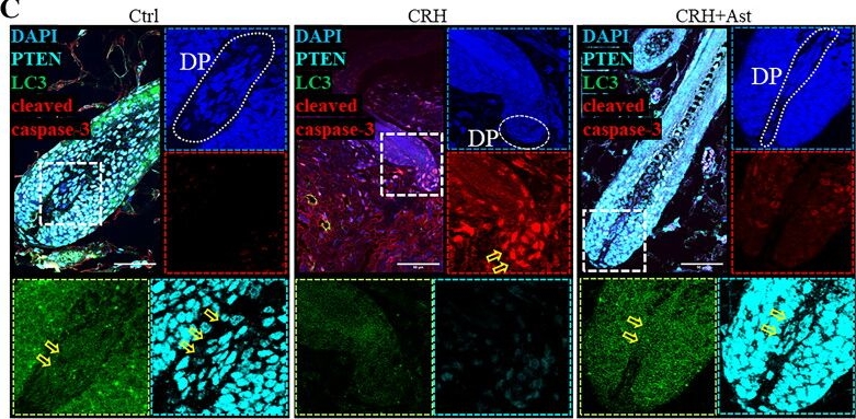 Fig.6.C showing Immunohistochemistry-immunofluorescence in a Mus musculus (House mouse) sample from the publication: Corticotropin-releasing hormone inhibits autophagy by suppressing PTEN to promote apoptosis in dermal papilla cells.