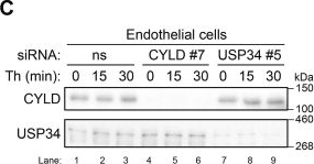 Fig.7.C showing Western Blotting in a Homo sapiens (Human) sample from the publication: An siRNA library screen identifies CYLD and USP34 as deubiquitinases that regulate GPCR-p38 MAPK signaling and distinct inflammatory responses.