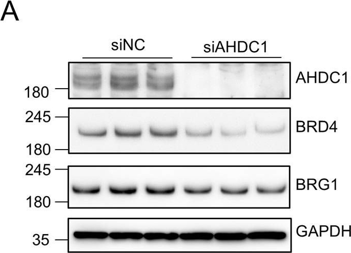 Fig.5.A showing Western Blotting in a Homo sapiens (Human) sample from the publication: AT-hook DNA-binding motif-containing protein one knockdown downregulates EWS-FLI1 transcriptional activity in Ewing's sarcoma cells.