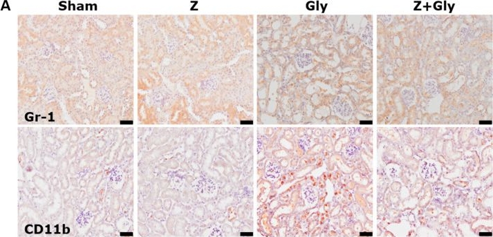 Fig.8.A showing Immunohistochemistry from the publication: Zileuton Attenuates Acute Kidney Injury in Glycerol-Induced Rhabdomyolysis by Regulating Myeloid-Derived Suppressor Cells in Mice.