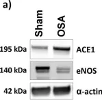 Fig.5.A showing Western Blotting from the publication: Aortic remodelling induced by obstructive apneas is normalized with mesenchymal stem cells infusion.