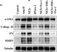 Fig.4.G showing Western Blotting in a Rattus norvegicus (Rat) sample from the publication: NETs drive myocardial fibrosis in hypertension via an NF-κB/ferroptosis axis.