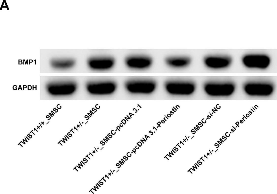 Fig.4.A showing Western Blotting in a Mus musculus (House mouse) sample from the publication: Periostin/Bone Morphogenetic Protein 1 axis axis regulates proliferation and osteogenic differentiation of sutured mesenchymal stem cells and affects coronal suture closure in the TWIST1+/- mouse model of craniosynostosis.