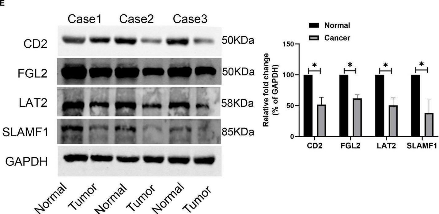 Fig.10.E showing Western Blotting from the publication: Identification and Validation of Immune Molecular Subtypes and Immune Landscape Based on Colon Cancer Cohort.