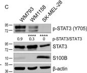 Fig.2.C showing Western Blotting from the publication: The calcium-binding protein S100B reduces IL6 production in malignant melanoma via inhibition of RSK cellular signaling.