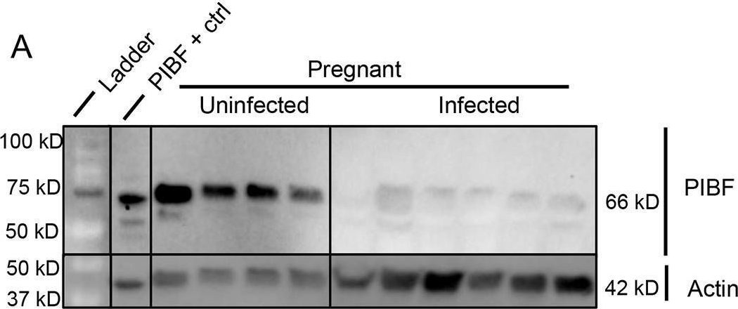 Fig.7.A showing Western Blotting from the publication: H1N1 influenza virus infection results in adverse pregnancy outcomes by disrupting tissue-specific hormonal regulation.