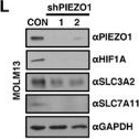 Fig.5.L showing Western Blotting in a Homo sapiens (Human) sample from the publication: PIEZO1 is Required for Acute Myeloid Leukemia Progression and Leukemia Stem Cell Maintenance via HIF1A-SLC7A11 Axis-Mediated Ferroptosis Defense.