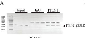 Fig.5.A showing Western Blotting from the publication: ITLN1 exacerbates Crohn's colitis by driving ZBP1-dependent PANoptosis in intestinal epithelial cells through antagonizing TRIM8-mediated CAPN2 ubiquitination.