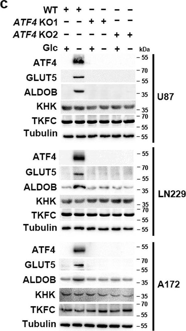 Fig.2.C showing Western Blotting in a Homo sapiens (Human) sample from the publication: ATF4-dependent fructolysis fuels growth of glioblastoma multiforme.