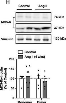 Fig.11.H showing Western Blotting in a Mus musculus (House mouse) sample from the publication: α-Melanocyte-stimulating hormone alleviates pathological cardiac remodeling via melanocortin 5 receptor.
