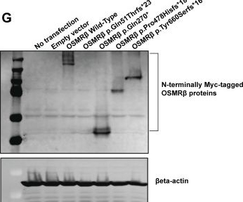 Fig.3.G showing Western Blotting in a Homo sapiens (Human) sample from the publication: Human germline biallelic loss-of-function OSMR variants cause severe allergic disease.